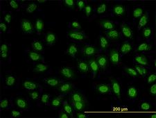 BCL9 Antibody - Immunofluorescence of monoclonal antibody to BCL9 on HeLa cell. [antibody concentration 10 ug/ml]