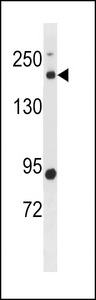 BCL9L Antibody - BCL9L Antibody western blot of human placenta tissue lysates (35 ug/lane). The BCL9L antibody detected the BCL9L protein (arrow).