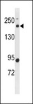 BCL9L Antibody - BCL9L Antibody western blot of human placenta tissue lysates (35 ug/lane). The BCL9L antibody detected the BCL9L protein (arrow).
