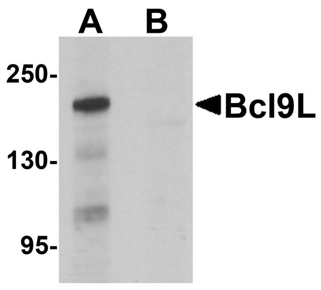 BCL9L Antibody - Western blot analysis of Bcl9L in HeLa cell lysate with Bcl9L antibody at 1 ug/ml in (A) the absence and (B) the presence of blocking peptide.