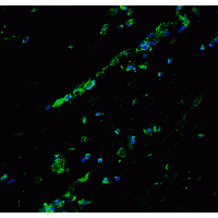 BCL9L Antibody - Immunofluorescence of Bcl9L in human breast tissue with Bcl9L antibody at 20 µg/ml.
