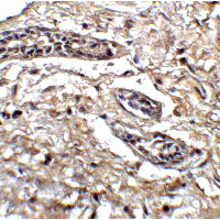 BCL9L Antibody - Immunohistochemistry of Bcl9L in human breast tissue with Bcl9L antibody at 5 µg/ml.