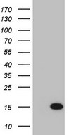 BCMP84 / S100A14 Antibody - HEK293T cells were transfected with the pCMV6-ENTRY control. (Left lane) or pCMV6-ENTRY S100A14. (Right lane) cDNA for 48 hrs and lysed. Equivalent amounts of cell lysates. (5 ug per lane) were separated by SDS-PAGE and immunoblotted with anti-S100A14. (1:2000)
