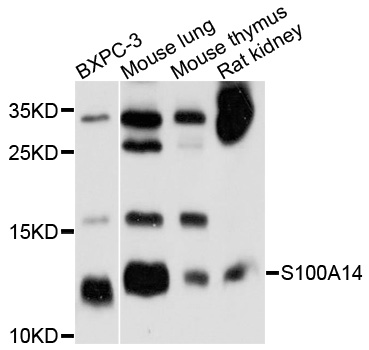 BCMP84 / S100A14 Antibody - Western blot analysis of extracts of various cell lines, using S100A14 antibody at 1:1000 dilution. The secondary antibody used was an HRP Goat Anti-Rabbit IgG (H+L) at 1:10000 dilution. Lysates were loaded 25ug per lane and 3% nonfat dry milk in TBST was used for blocking. An ECL Kit was used for detection and the exposure time was 30s.