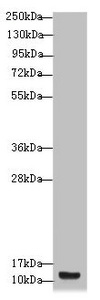BCMP84 / S100A14 Antibody - Western blot All Lanes: S100A14 antibody at 4.11 ug/ml+ A431 whole cell lysate Secondary Goat polyclonal to rabbit IgG at 1/10000 dilution Predicted band size: 12 kDa Observed band size: 12 kDa