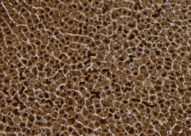 BCMP84 / S100A14 Antibody - 1:100 staining rat liver tissue by IHC-P. The sample was formaldehyde fixed and a heat mediated antigen retrieval step in citrate buffer was performed. The sample was then blocked and incubated with the antibody for 1.5 hours at 22°C. An HRP conjugated goat anti-rabbit antibody was used as the secondary.