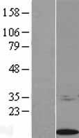 BCMP84 / S100A14 Protein - Western validation with an anti-DDK antibody * L: Control HEK293 lysate R: Over-expression lysate