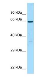 BCO1 / BCMO1 Antibody - BCMO1 antibody Western Blot of Placenta.  This image was taken for the unconjugated form of this product. Other forms have not been tested.