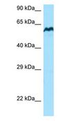 BCO1 / BCMO1 Antibody - BCMO1 antibody Western Blot of A549 cell lysates. Antibody Dilution: 1.0 ug/ml. BCMO1 is supported by BioGPS gene expression data to be expressed in A549. Antibody dilution: 1 ug/ml.  This image was taken for the unconjugated form of this product. Other forms have not been tested.