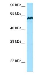 BCO1 / BCMO1 Antibody - BCMO1 antibody Western Blot of A549 cell lysates. Antibody Dilution: 1.0 ug/ml. BCMO1 is supported by BioGPS gene expression data to be expressed in A549. Antibody dilution: 1 ug/ml.  This image was taken for the unconjugated form of this product. Other forms have not been tested.