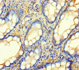 BCO1 / BCMO1 Antibody - Immunohistochemistry of paraffin-embedded human small intestine tissue using BCO1 Antibody at dilution of 1:100