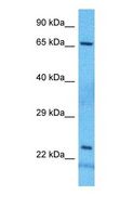 BCO1 / BCMO1 Antibody - Western blot of BCMO1 Antibody with human 721_B Whole Cell lysate.  This image was taken for the unconjugated form of this product. Other forms have not been tested.