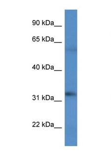 BCO2 / BCDO2 Antibody - BCO2 antibody Western blot of HT1080 Cell lysate. Antibody concentration 1 ug/ml.  This image was taken for the unconjugated form of this product. Other forms have not been tested.