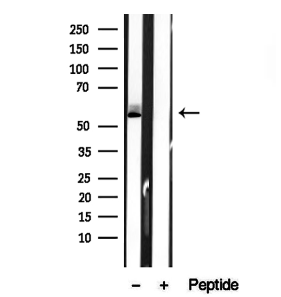 BCO2 / BCDO2 Antibody - Western blot analysis of extracts of L02 cells using BCO2 antibody.