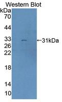 BCOR Antibody - Western blot of BCOR antibody.