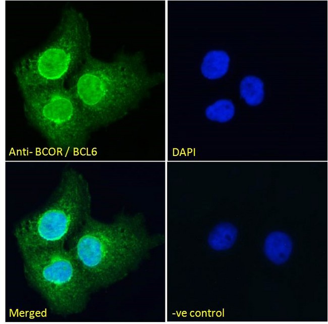 BCOR Antibody - Goat Anti-BCOR / BCL6 co-repressor Antibody Immunofluorescence analysis of paraformaldehyde fixed A431 cells, permeabilized with 0.15% Triton. Primary incubation 1hr (10ug/ml) followed by Alexa Fluor 488 secondary antibody (2ug/ml), showing nuclear and weak cytoplasmic staining. The nuclear stain is DAPI (blue). Negative control: Unimmunized goat IgG (10ug/ml) followed by Alexa Fluor 488 secondary antibody (2ug/ml).