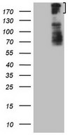 BCOR Antibody - HEK293T cells were transfected with the pCMV6-ENTRY control. (Left lane) or pCMV6-ENTRY BCOR. (Right lane) cDNA for 48 hrs and lysed. Equivalent amounts of cell lysates. (5 ug per lane) were separated by SDS-PAGE and immunoblotted with anti-BCOR.
