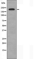 BCOR Antibody - Western blot analysis of extracts of COLO cells using BCOR antibody.