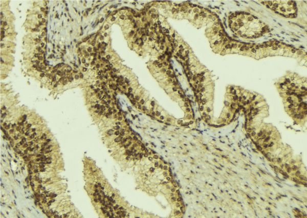 BCOR Antibody - 1:100 staining mouse colon tissue by IHC-P. The sample was formaldehyde fixed and a heat mediated antigen retrieval step in citrate buffer was performed. The sample was then blocked and incubated with the antibody for 1.5 hours at 22°C. An HRP conjugated goat anti-rabbit antibody was used as the secondary.