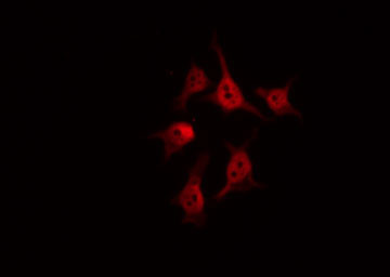 BCOR Antibody - Staining COLO205 cells by IF/ICC. The samples were fixed with PFA and permeabilized in 0.1% Triton X-100, then blocked in 10% serum for 45 min at 25°C. The primary antibody was diluted at 1:200 and incubated with the sample for 1 hour at 37°C. An Alexa Fluor 594 conjugated goat anti-rabbit IgG (H+L) Ab, diluted at 1/600, was used as the secondary antibody.