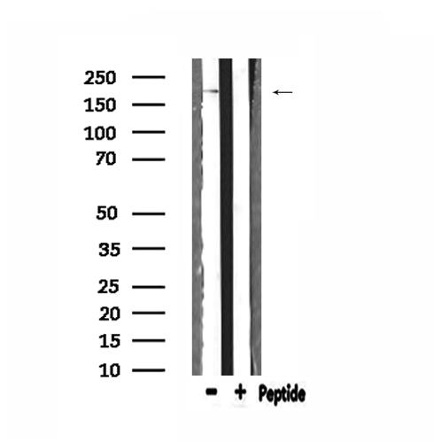 BCOR Antibody - Western blot analysis of extracts of HeLa cells using BCOR antibody.