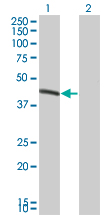 BCS1L Antibody - Western Blot analysis of BCS1L expression in transfected 293T cell line by BCS1L monoclonal antibody (M01), clone 5F3.Lane 1: BCS1L transfected lysate(47.534 KDa).Lane 2: Non-transfected lysate.