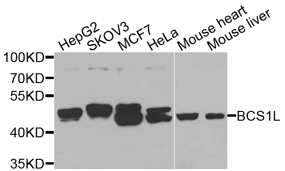 BCS1L Antibody - Western blot analysis of extracts of various cell lines.