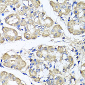 BCS1L Antibody - Immunohistochemistry of paraffin-embedded human stomach tissue.