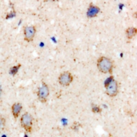 BCS1L Antibody - Immunohistochemical analysis of BCS1L staining in rat brain formalin fixed paraffin embedded tissue section. The section was pre-treated using heat mediated antigen retrieval with sodium citrate buffer (pH 6.0). The section was then incubated with the antibody at room temperature and detected using an HRP conjugated compact polymer system. DAB was used as the chromogen. The section was then counterstained with hematoxylin and mounted with DPX.