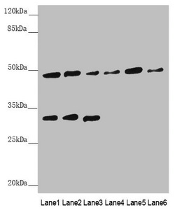BCS1L Antibody - Western blot All Lanes: BCS1L antibody at 5.04 ug/ml Lane 1: Mouse kidney tissue Lane 2: Mouse liver tissue Lane 3: Mouse brain tissue Lane 4: A549 whole cell lysate Lane 5: 293T whole cell lysate Lane 6: Hela whole cell lysate Secondary Goat polyclonal to rabbit IgG at 1/10000 dilution Predicted band size: 48 kDa Observed band size: 48,30 kDa