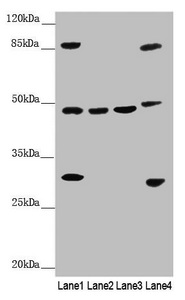 BCS1L Antibody - Western blot All Lanes: BCS1L antibody at 3.07 ug/ml Lane 1: Mouse liver tissue Lane 2: A549 whole cell lysate Lane 3: 293T whole cell lysate Lane 4: Hela whole cell lysate Secondary Goat polyclonal to rabbit IgG at 1/10000 dilution Predicted band size: 48 kDa Observed band size: 48,30,85 kDa