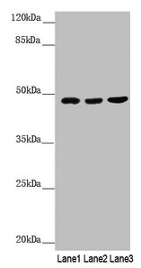 BCS1L Antibody - Western blot All lanes: BCS1L antibody at 3.07µg/ml Lane 1: A549 whole cell lysate Lane 2: 293T whole cell lysate Lane 3: Hela whole cell lysate Secondary Goat polyclonal to rabbit IgG at 1/10000 dilution Predicted band size: 48 kDa Observed band size: 48 kDa