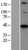 BCS1L Protein - Western validation with an anti-DDK antibody * L: Control HEK293 lysate R: Over-expression lysate
