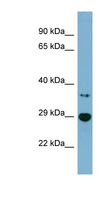 BDH2 Antibody - BDH2 antibody Western blot of Jurkat lysate. This image was taken for the unconjugated form of this product. Other forms have not been tested.