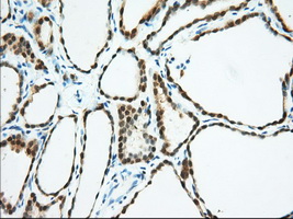 BDH2 Antibody - IHC of paraffin-embedded Human thyroid tissue using anti-BDH2 mouse monoclonal antibody. (Dilution 1:50).