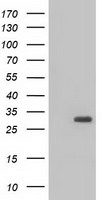 BDH2 Antibody - HEK293T cells were transfected with the pCMV6-ENTRY control (Left lane) or pCMV6-ENTRY BDH2 (Right lane) cDNA for 48 hrs and lysed. Equivalent amounts of cell lysates (5 ug per lane) were separated by SDS-PAGE and immunoblotted with anti-BDH2.