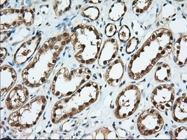 BDH2 Antibody - IHC of paraffin-embedded Human Kidney tissue using anti-BDH2 mouse monoclonal antibody. (Dilution 1:50).
