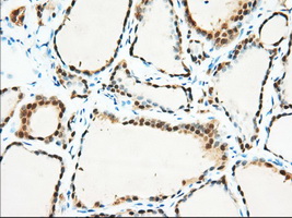 BDH2 Antibody - IHC of paraffin-embedded Human thyroid tissue using anti-BDH2 mouse monoclonal antibody. (Dilution 1:50).