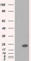 BDH2 Antibody - HEK293T cells were transfected with the pCMV6-ENTRY control (Left lane) or pCMV6-ENTRY BDH2 (Right lane) cDNA for 48 hrs and lysed. Equivalent amounts of cell lysates (5 ug per lane) were separated by SDS-PAGE and immunoblotted with anti-BDH2.