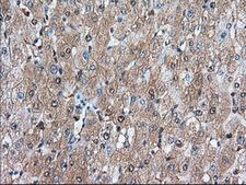 BDH2 Antibody - Immunohistochemical staining of paraffin-embedded Human liver tissue using anti-BDH2 mouse monoclonal antibody. (Dilution 1:50).
