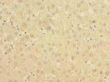 BDH2 Antibody - Immunohistochemistry of paraffin-embedded human liver tissue using antibody at dilution of 1:100.