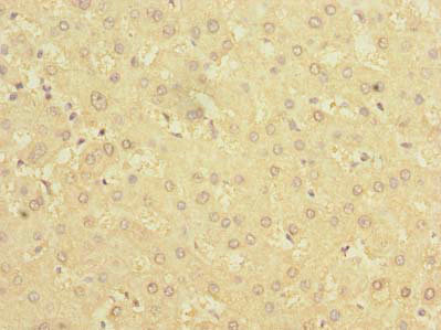 BDH2 Antibody - Immunohistochemistry of paraffin-embedded human liver tissue using BDH2 Antibody at dilution of 1:100