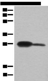 BDH2 Antibody - Western blot analysis of Mouse kidney tissue and A172 cell lysates  using BDH2 Polyclonal Antibody at dilution of 1:600