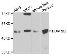 BDKRB2/Bradykinin B2 Receptor Antibody - Western blot analysis of extracts of various cells.