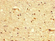 BDKRB2/Bradykinin B2 Receptor Antibody - Immunohistochemistry image at a dilution of 1:300 and staining in paraffin-embedded human brain tissue performed on a Leica BondTM system. After dewaxing and hydration, antigen retrieval was mediated by high pressure in a citrate buffer (pH 6.0) . Section was blocked with 10% normal goat serum 30min at RT. Then primary antibody (1% BSA) was incubated at 4 °C overnight. The primary is detected by a biotinylated secondary antibody and visualized using an HRP conjugated SP system.