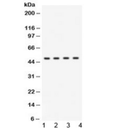 BDKRB2/Bradykinin B2 Receptor Antibody - Western blot testing of human 1) HeLa, 2) HepG2, 3) MCF7, and 4) A549 lysate with BDKRB2 antibody at 0.5ug/ml. Predicted molecular weight ~44 kDa.