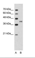 BDKRB2/Bradykinin B2 Receptor Antibody - A: Marker, B: Jurkat Cell Lysate.  This image was taken for the unconjugated form of this product. Other forms have not been tested.