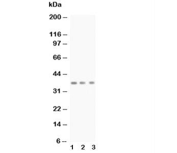 BDNF Antibody - Western blot testing of BDNF antibody and Lane 1: rat brain; 2: mouse brain; 3: MCF-7; Predicted size: 28KD; Observed size: 37KD