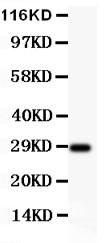 BDNF Antibody - BDNF antibody Western blot. All lanes: Anti-BDNF at 0.5 ug/ml. WB: Rat Brain Tissue Lysate at 40 ug. Predicted band size: 28 kD. Observed band size: 28 kD.