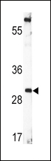 BDNF Antibody - Western blot of BDNF Antibody in CEM cell line lysates (35 ug/lane). BDNF (arrow) was detected using the purified antibody.